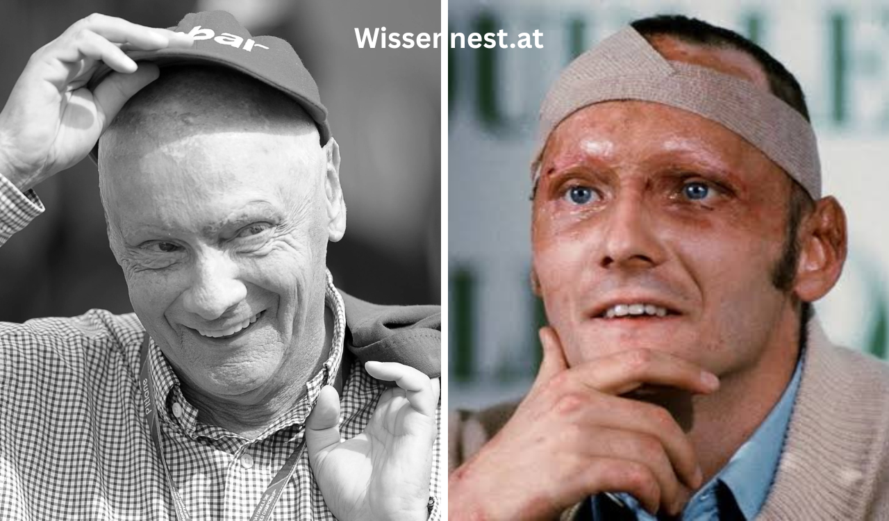 Niki Lauda Todesursache Niki Lauda Todesursache
